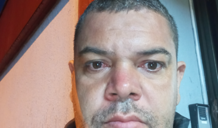 Colocar implates de dentes na boca