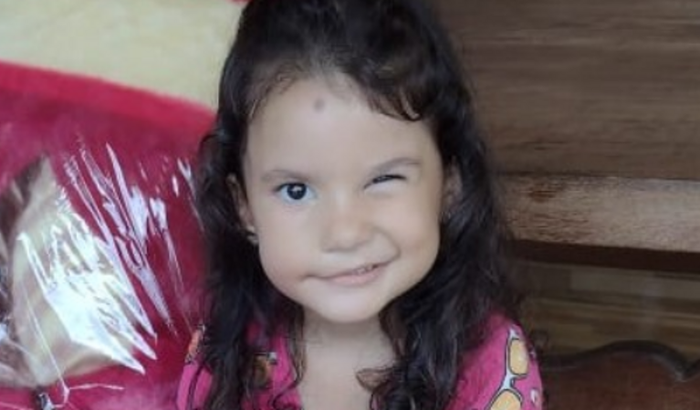 Transplante Paralisia facial Maria Clara