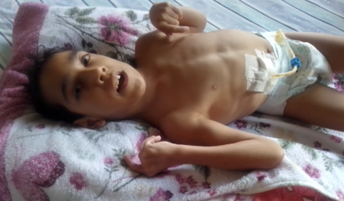 Nutrição Pediasure Para o LéoO.(2)