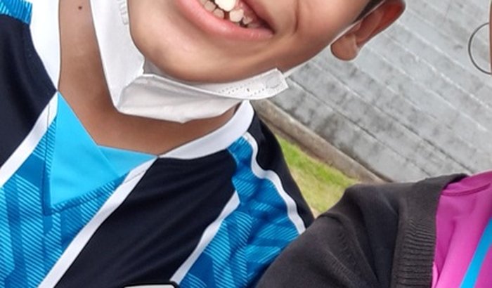 Aparelho ortodontico do @ryan.ojovemheroi