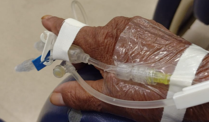 Tratamento Oncológico