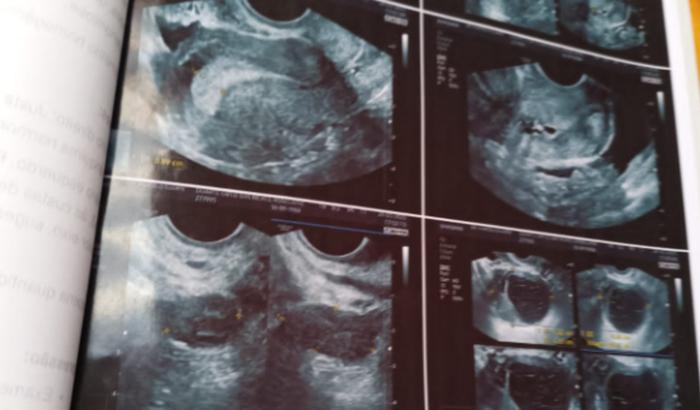 Ajuda para realizar cirurgia de minha mãe 