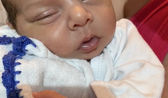 Leite para o bebe APLV