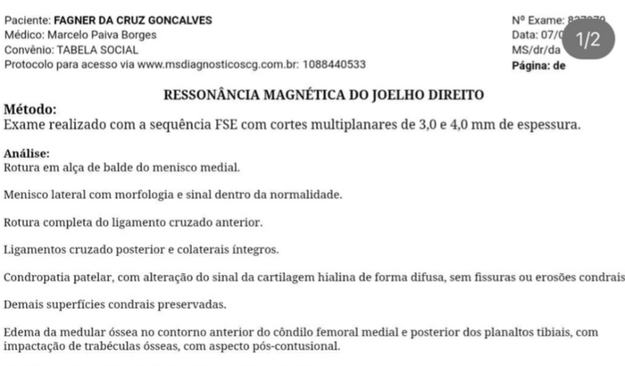Cirurgia no Joelho! O sus nao cobre a cirurgia e nao tenho condições de bancar sozinho, quem puder ajudar 🙏🏽