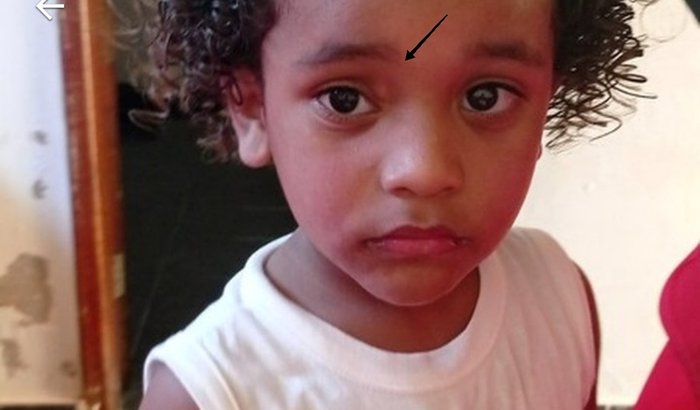 Ajuda para a cirurgia do meu filho Arthur 