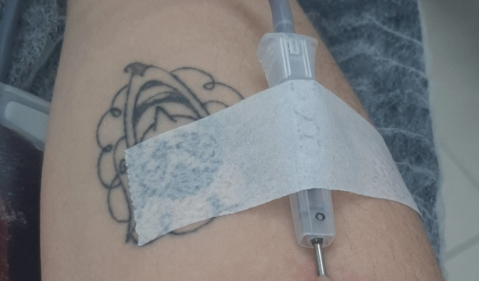 Tratamento de endometriose, SOP e transtornos mentais