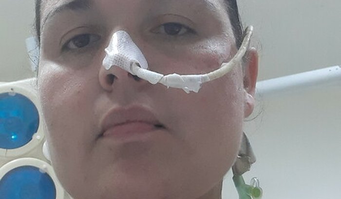 Minha cirurgia de acalasia de mega esôfago