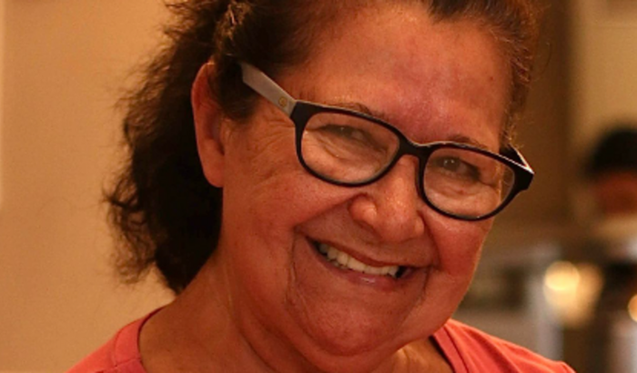 Cirurgia Prótese Total Fêmur - RUTE LUIZA RAIMUNDO
