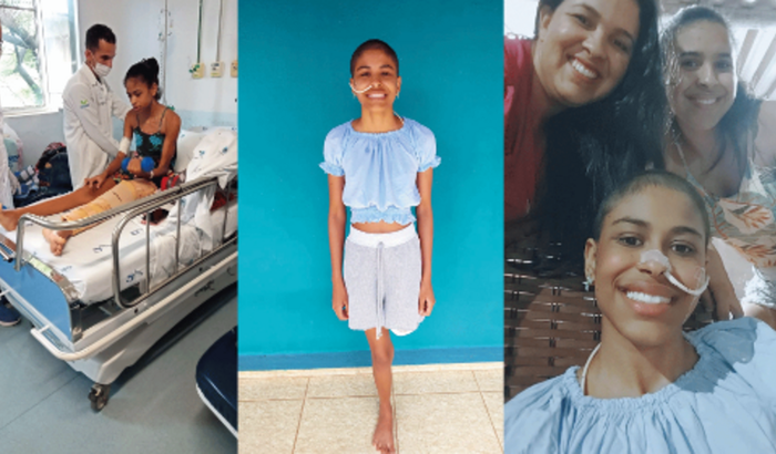 AJUDA PARA A PRÓTESE DA FLÁVIA