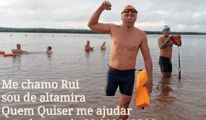 Ajuda para comprar uma prótese