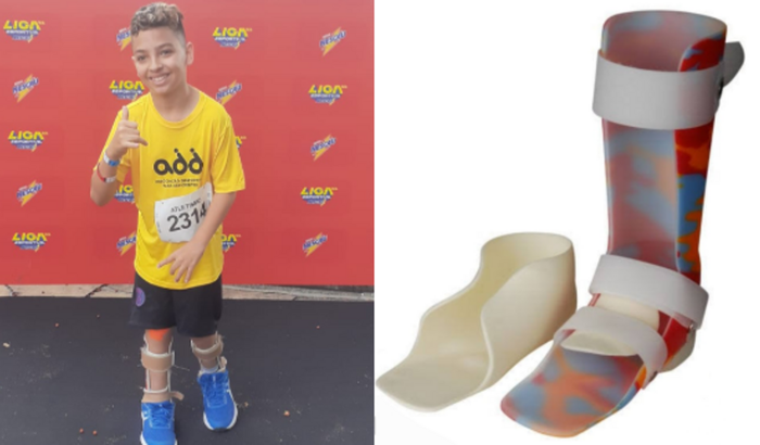 Vamos ajudar o Pedro a comprar uma ortese