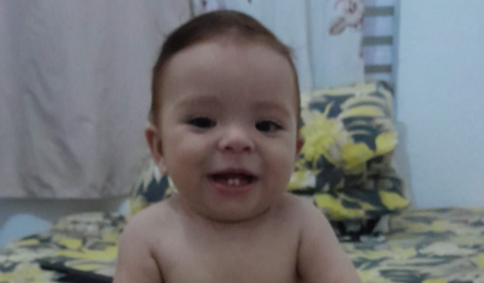 Eletroencefalograma com mapeamento 3D mais foto estimulo