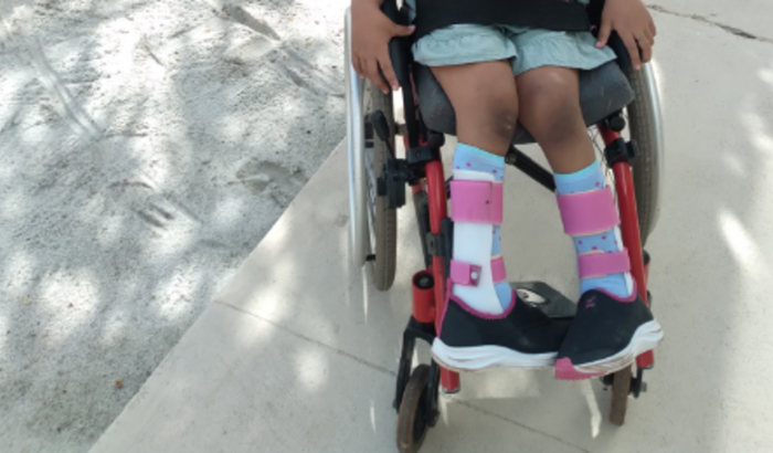 Ajudar Maria Eduarda fazer um cirurgia no pé 