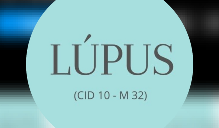 Ajuda a fazer tratamento de lúpus 