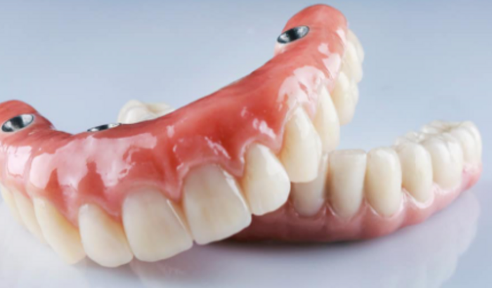 Prótese Dentária para Mainha