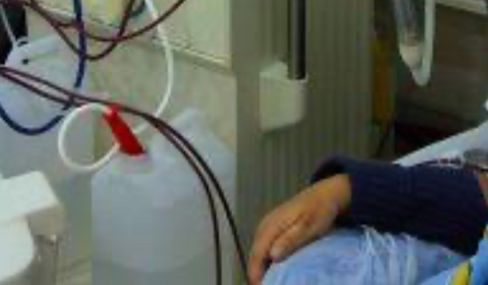 Transplante de rins