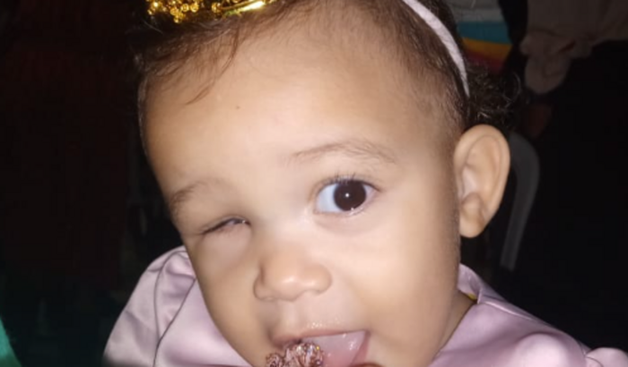 Júlia no tratamento da sua prótese