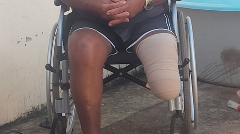 Ajudar comprar uma prótese 