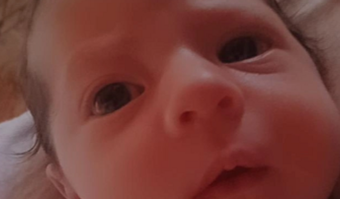 Tratamento da Yasmim após o pai quebra seu crânio com um socosoco