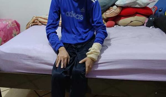 Ajude Carlos a realizar uma cirurgia no Quadril esquerdo