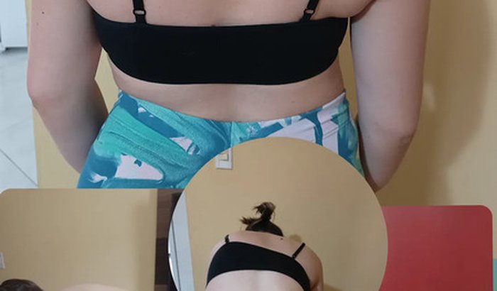 Ajuda para Cirurgia de Escoliose da Thaís Mira