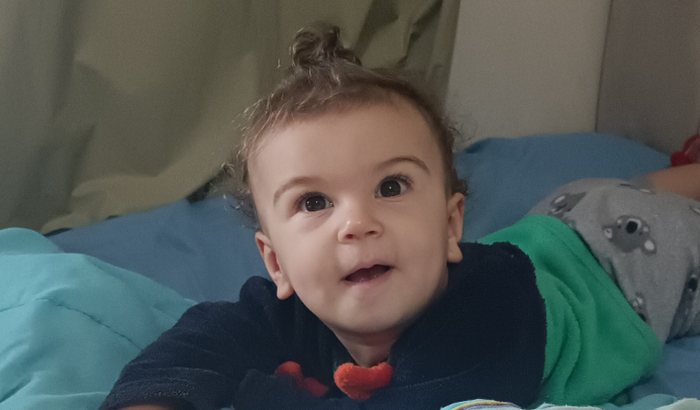 Tratamento órtese craniana - Luiza 