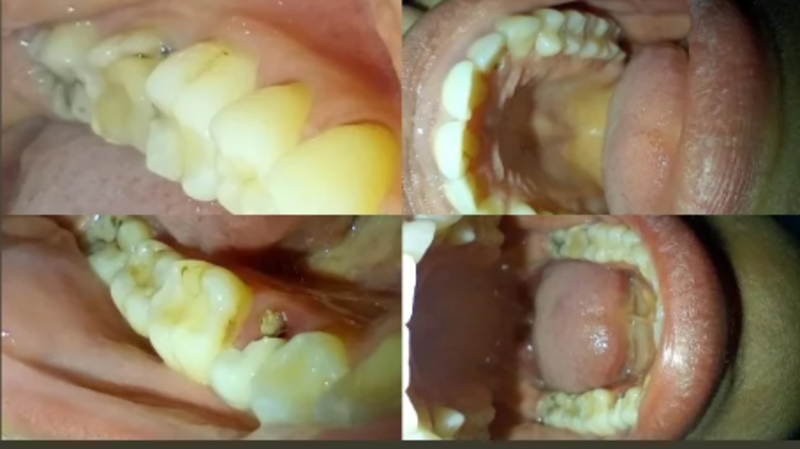 Ajude-me com meu tratamento dentário.