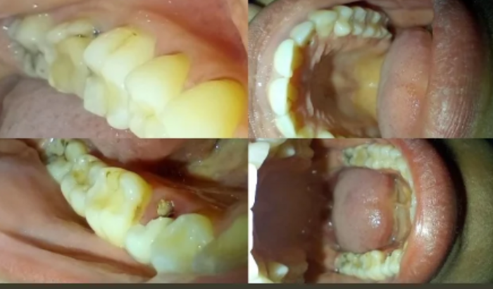 Ajude-me com meu tratamento dentário.