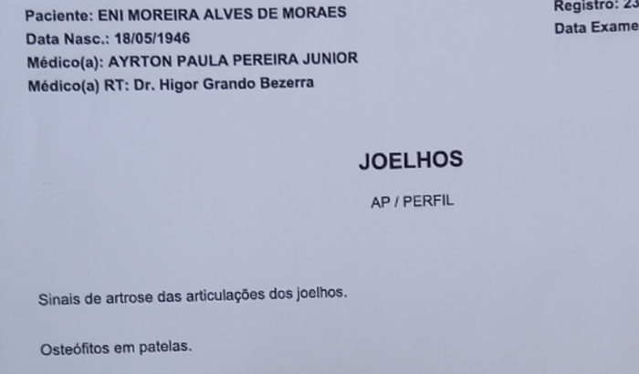 Cirurgia nos joelhos da Dona Eni