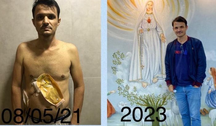 Drenagem via biliar de urgência