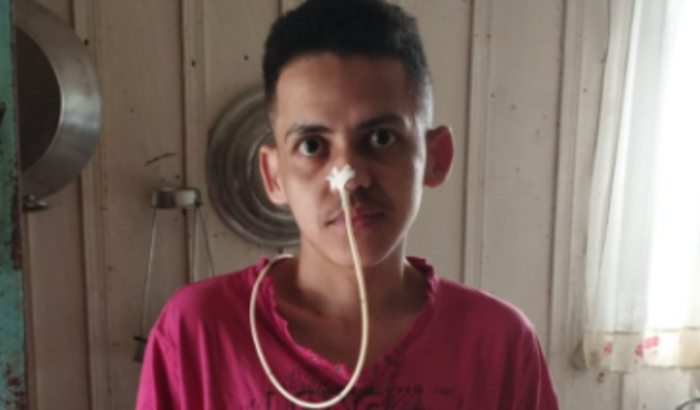 Tratamento cirúrgico Lucas Evangelista