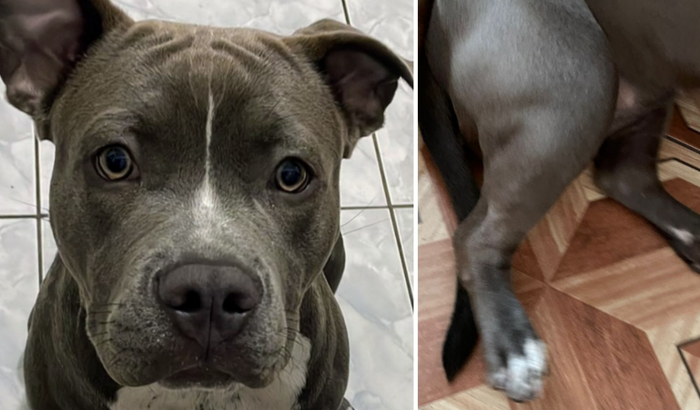 Cirurgia Gaia - Avulsão da Tuberosidade da Tíbia Direita