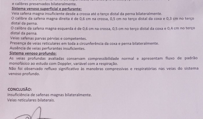 Safenectomia bilateral para Elvis Calafati Alves