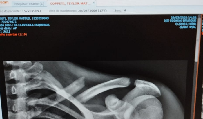 Teylor Matheus coppeti