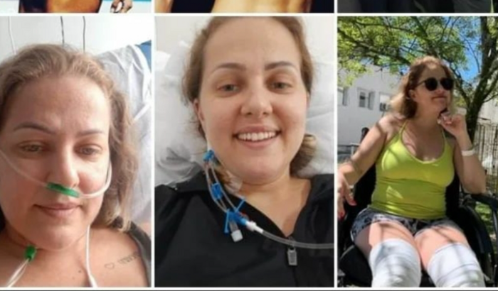 TRATAMENTO E ACOMPANHAMENO MÉDICO PARA SÍNDROME DE ADDISON, SINDROME CONVERSIVA E DISAUTONOMIA. 