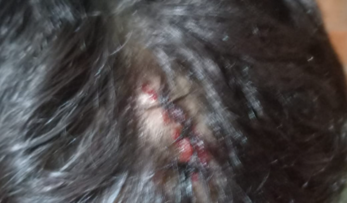 Salva a vida do meu filho 