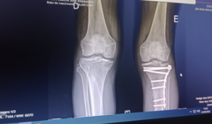 Concerto do material de trabalho após acidente automobilístico