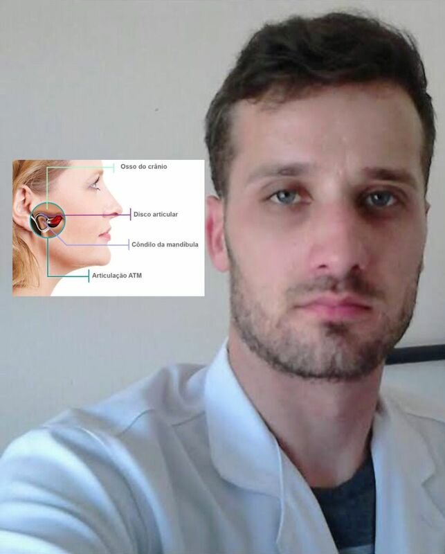 Cirurgia Neuralgia do Nervo Trigêmeo 