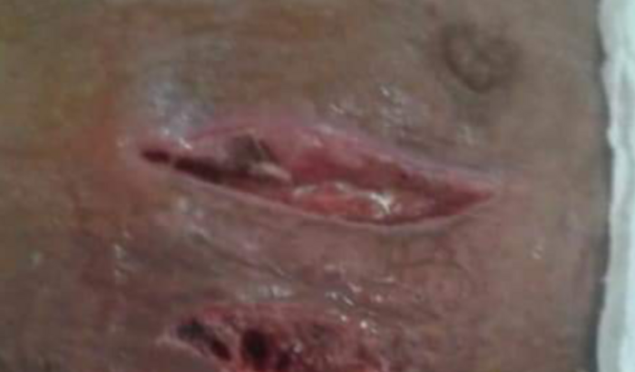 Juntos pela Andréia