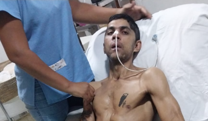 TRATAMENTO SARGENTO BM TADEU