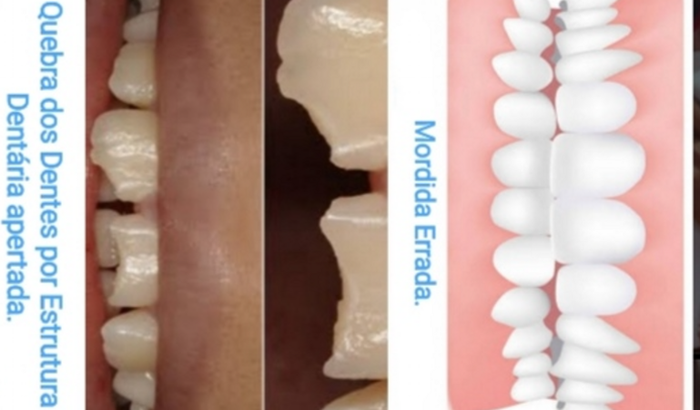 Ajude Nara em seu Tratamento Bucal.