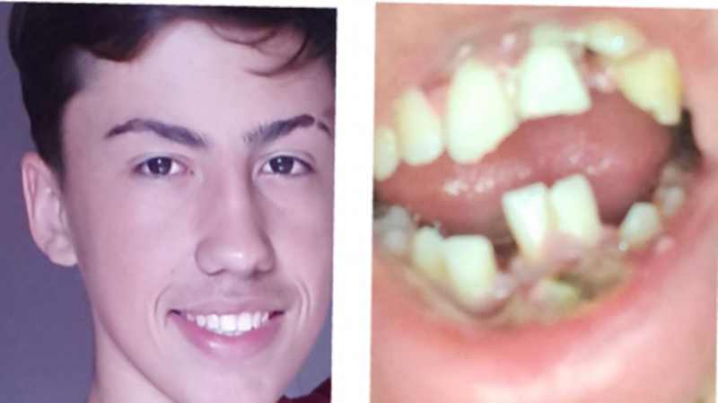 imagem da vaquinha Ajude o Victor a recuperar o seu sorriso