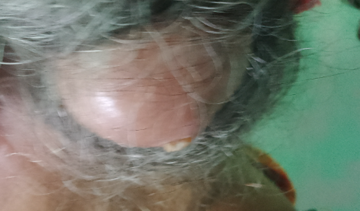 Ajude na Cirurgia Da minha vó