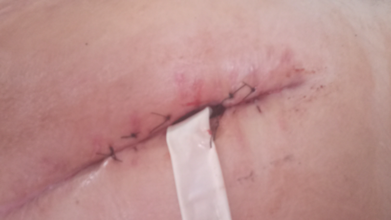 imagem da vaquinha Me ajude na recuperacao