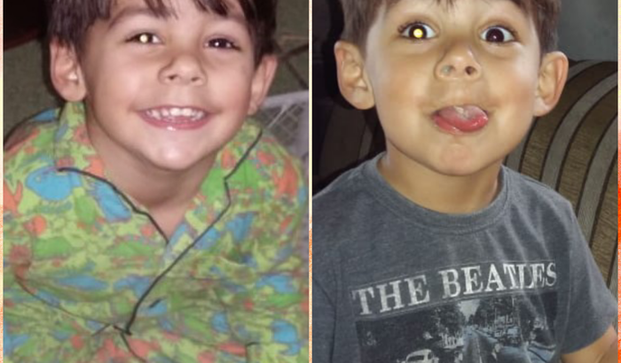 Benicio contra doença rara
