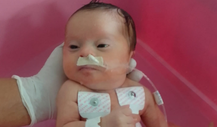 Ajuda a Compra leite infratrini para à Eloá.