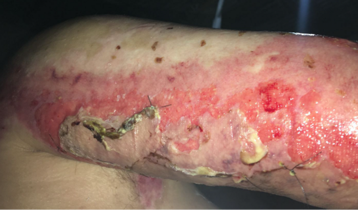 Ajudem minha prima no tratamento dela