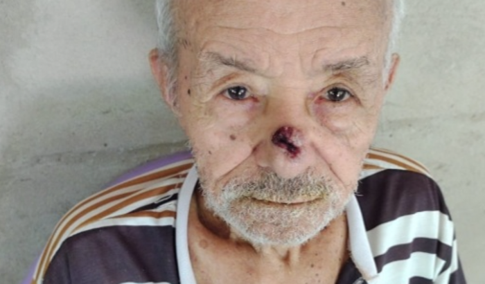 Necessita de uma cirurgia na face URGENTE