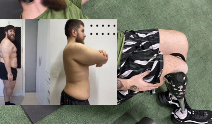 Me ajude a comprar uma perna nova!