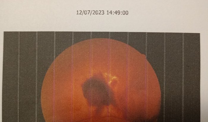 Procedimento cirúrgico urgente